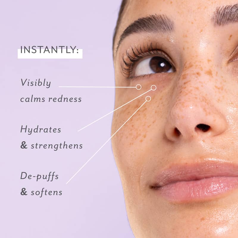 Skin Remedy Soothing Eye Gels